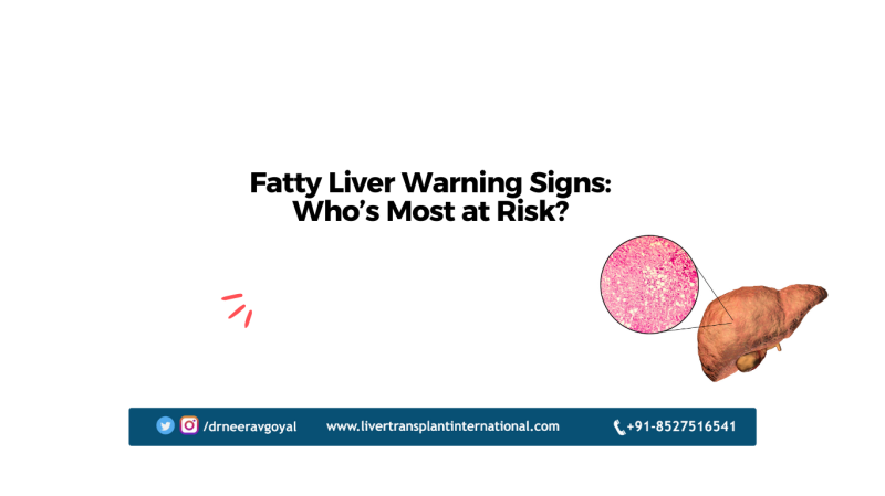 Fatty Liver Warning Signs: Who’s Most at Risk?: ext_6753528 — LiveJournal