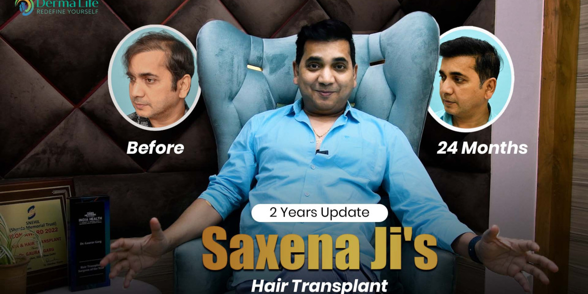 Top Celebrity Hair Transplant Doctor in India: Clinical Expertise and Aesthetic Precision