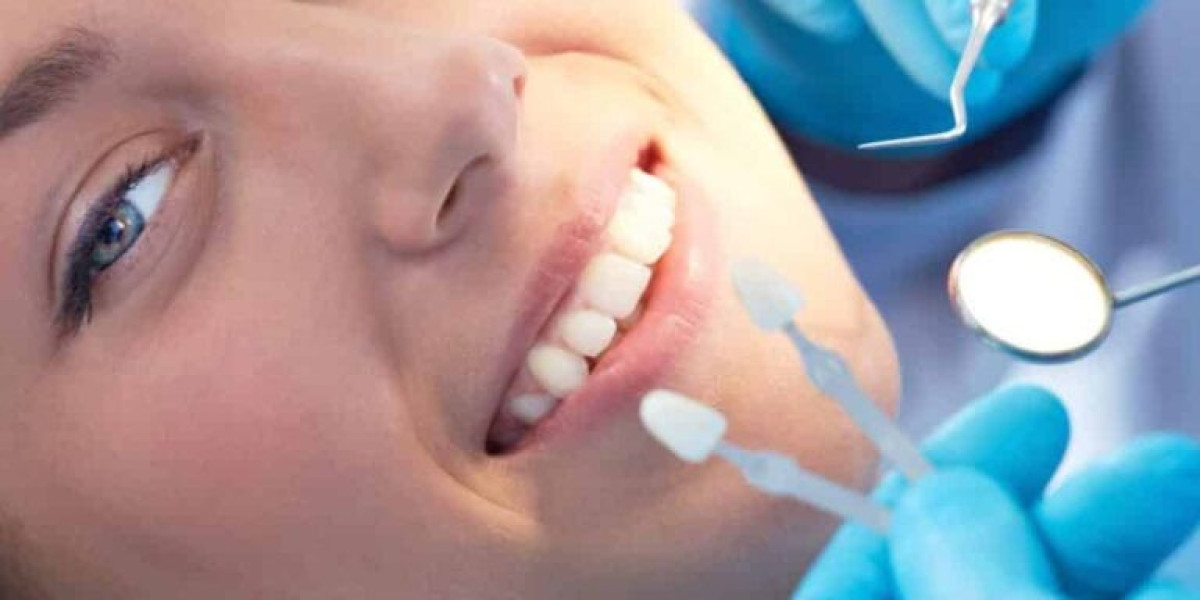 Why Choosing Dentist Canterbury is Essential for Oral Health